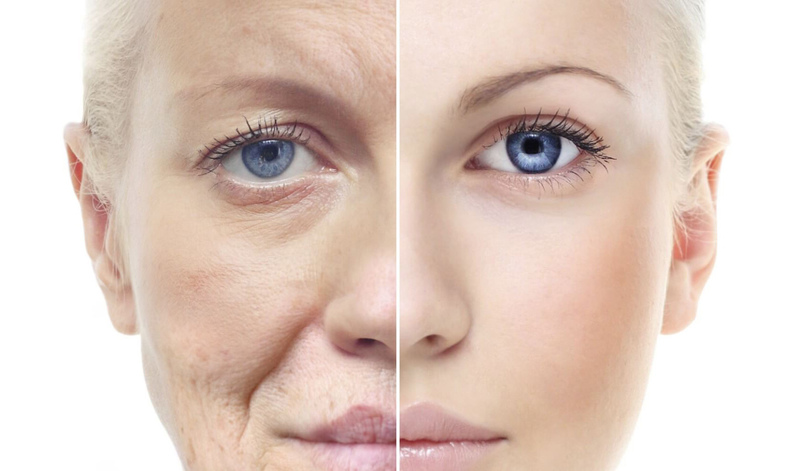 Дряблая кожа | Медицинская эстетическая косметология